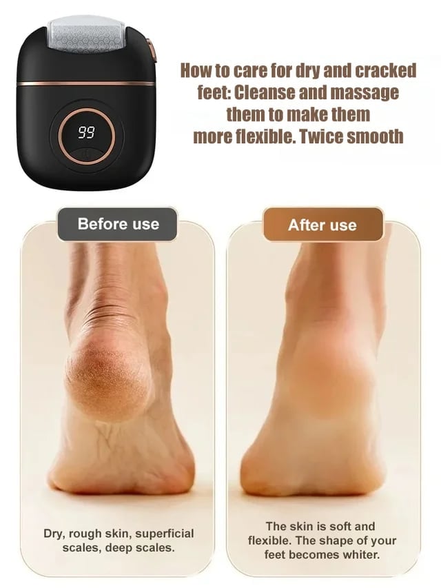 Digital Electric Foot Polisher